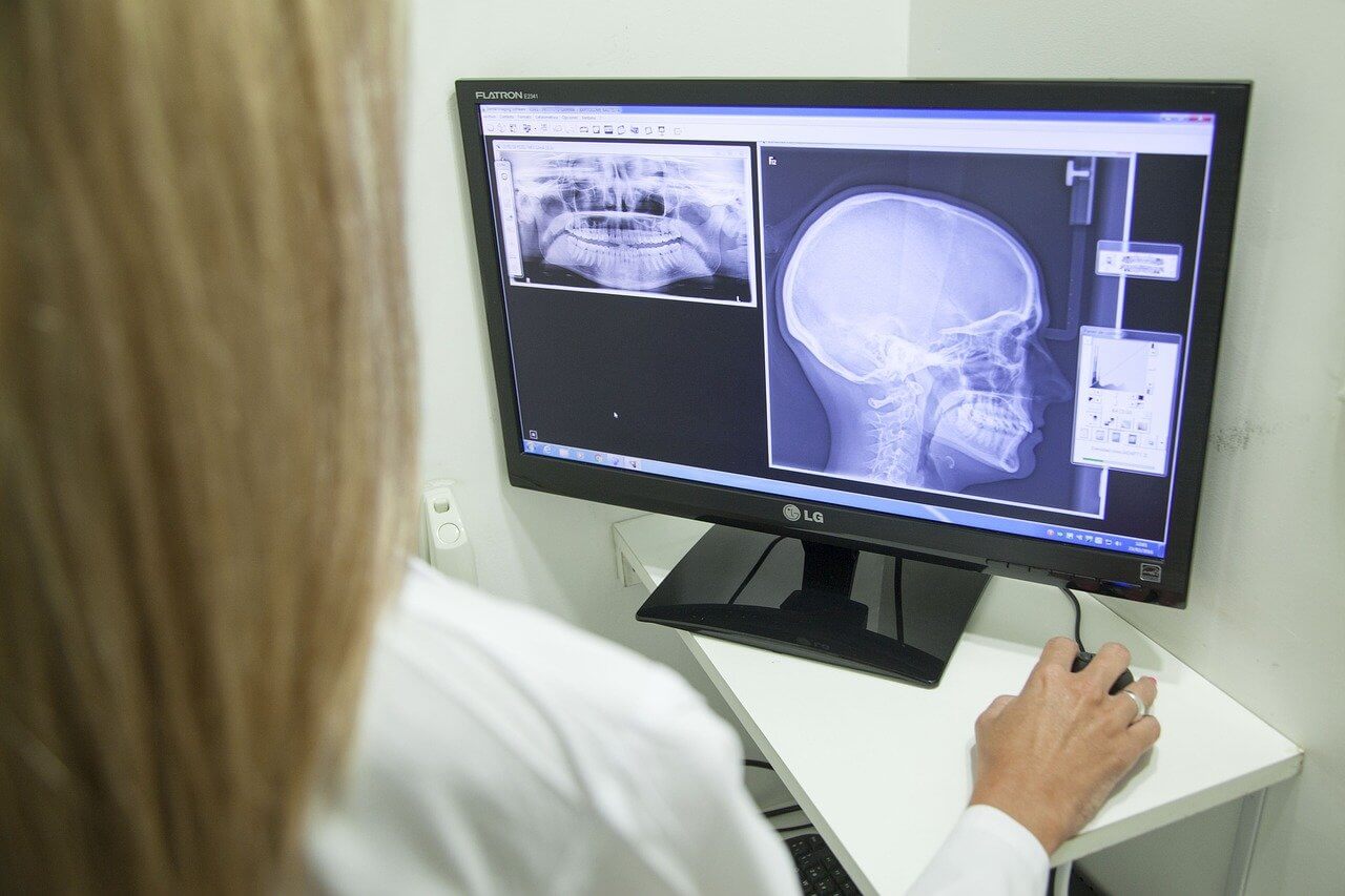 Confira vantagens da radiologia digital no atendimento ao paciente